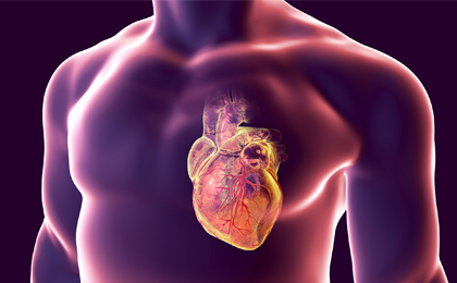 Image for Cardiovascular - VTE